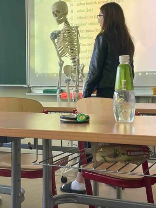 17
